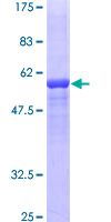 12.5% SDS-PAGE Stained with Coomassie Blue.